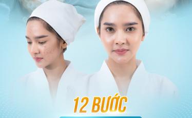 12 Bước Điều Trị Mụn Chuẩn Y Khoa tại Phòng khám Đa khoa AIVI 12 Bước Điều Trị Mụn Chuẩn Y Khoa tại Phòng khám Đa khoa AIVI