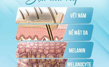 Cấu trúc da nám bạn cần biết Cấu trúc da nám bạn cần biết