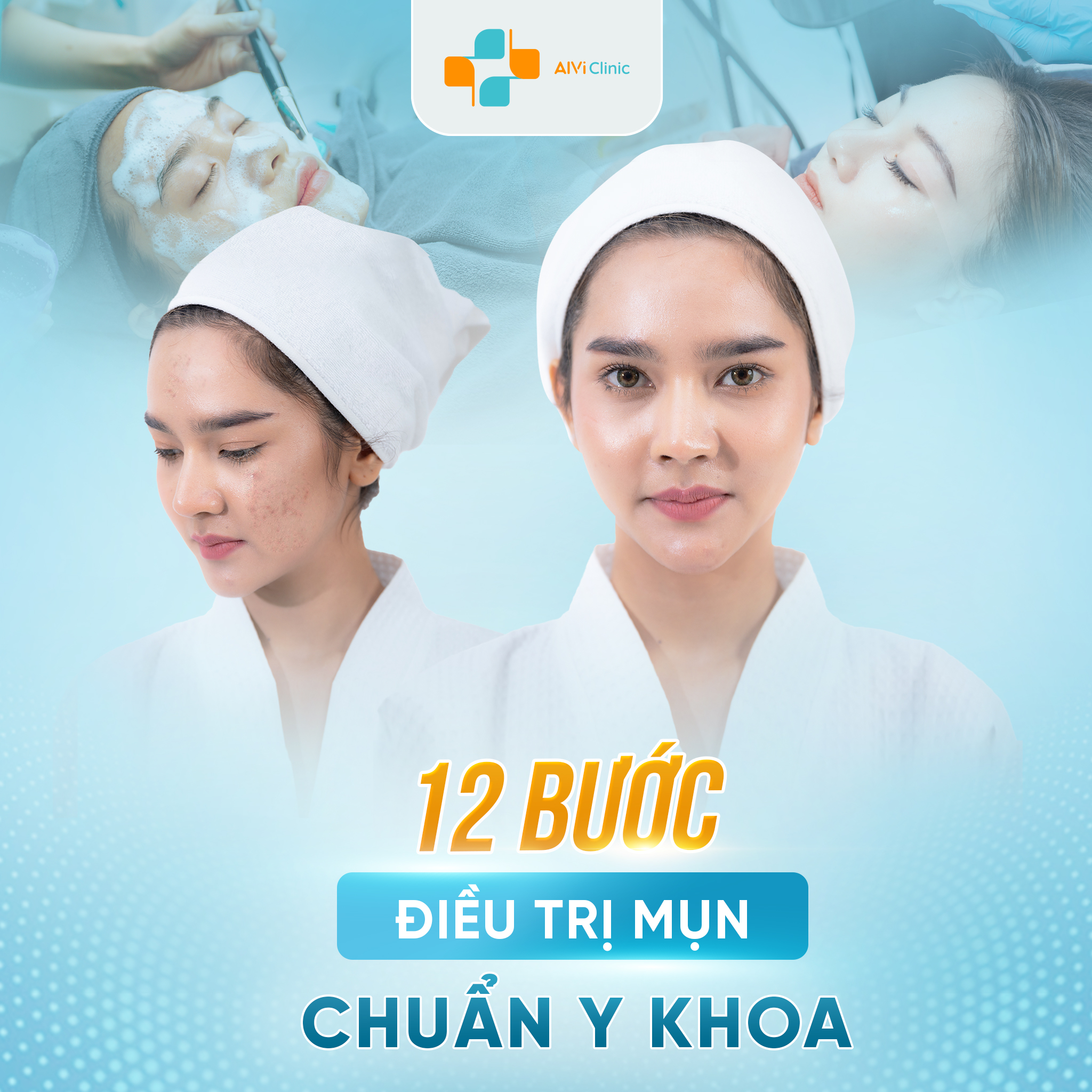 12 Bước Điều Trị Mụn Chuẩn Y Khoa tại Phòng khám Đa khoa AIVI