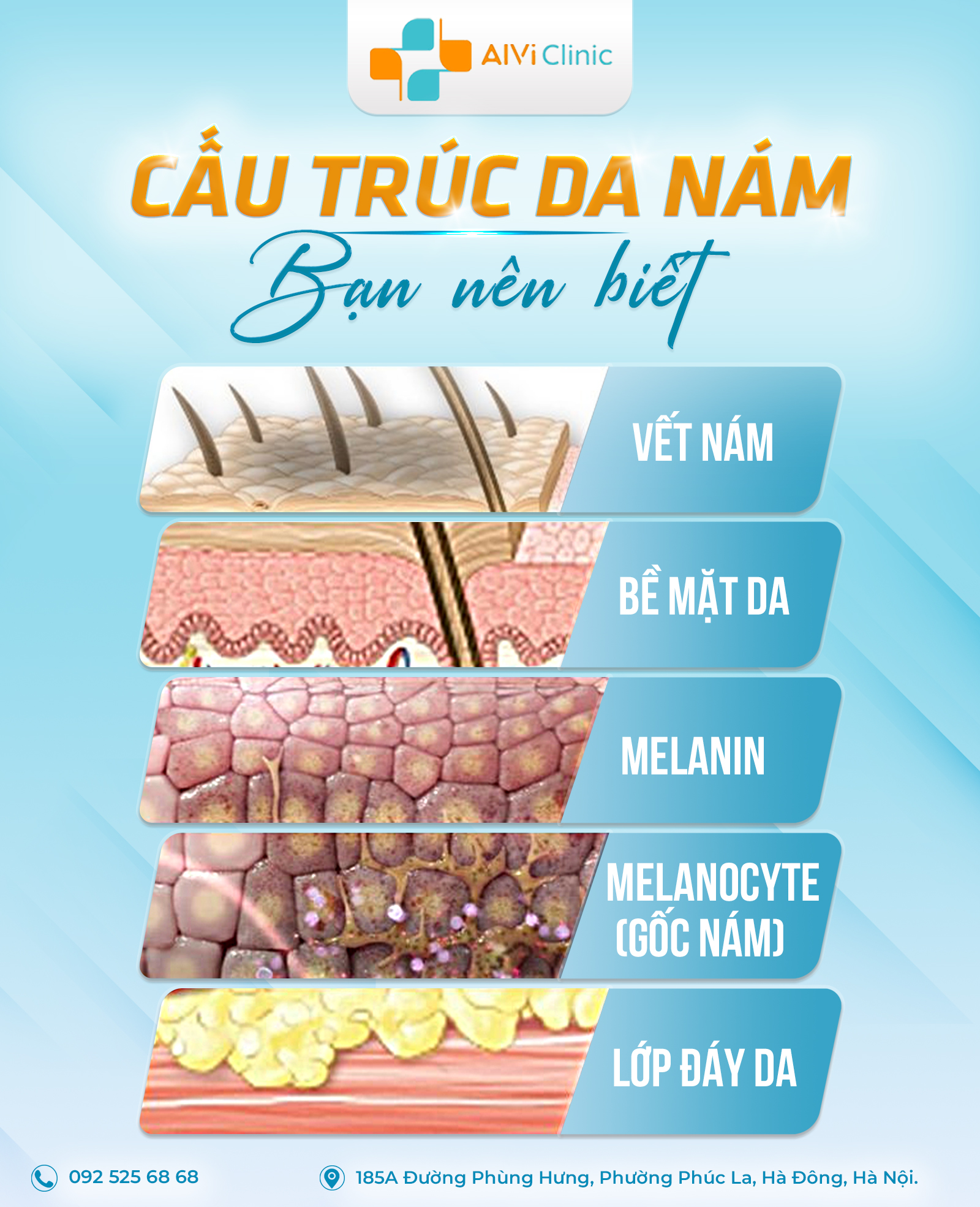 Cấu trúc da nám bạn cần biết