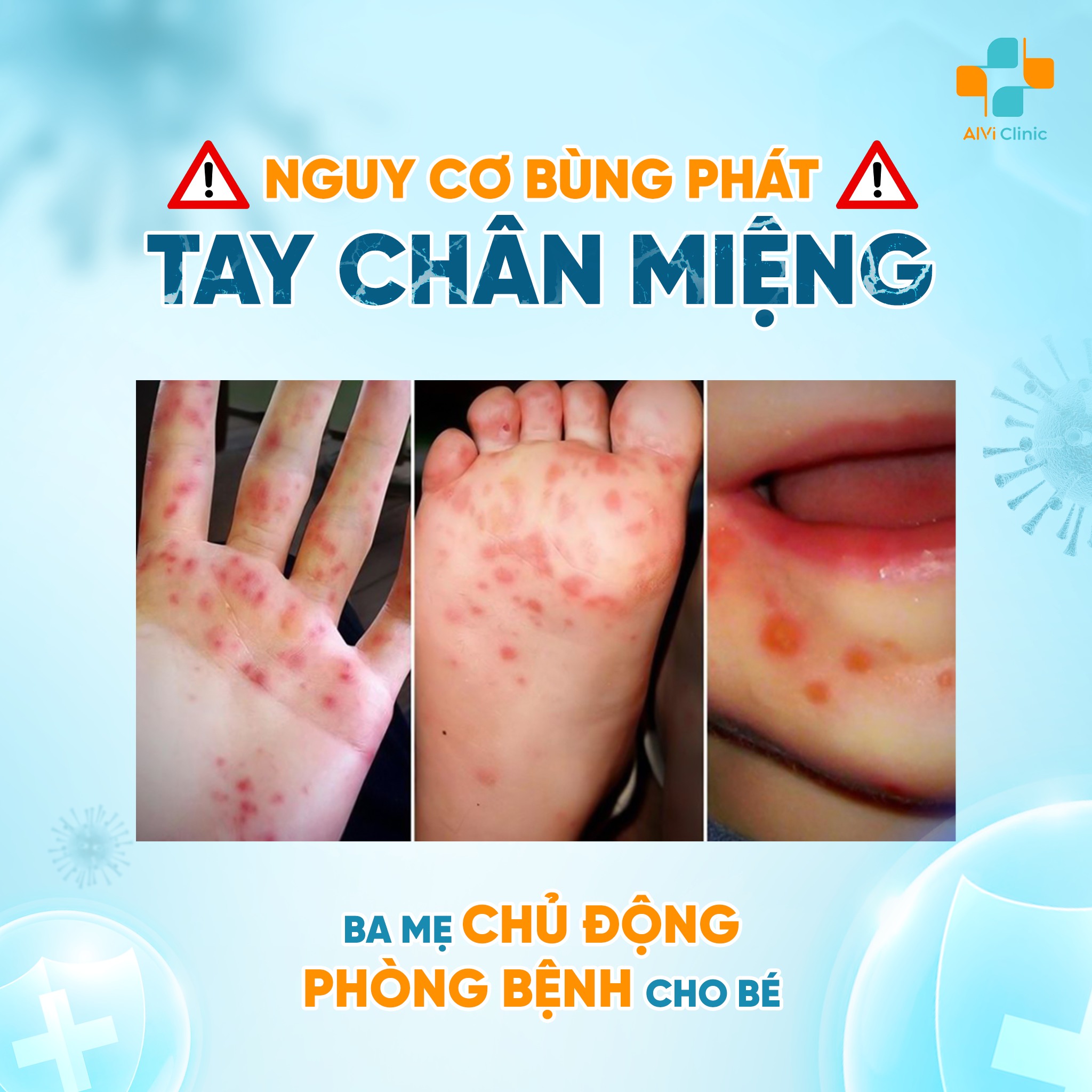 Chân tay miệng